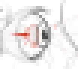 Photo Inteligentné kontaktné šošovky dokážu včas rozpoznať zelený zákal