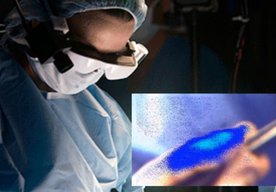 Photo Chirurgovia budú pri odstraňovaní nádorov používať inteligentné okuliare aby boli presnejší