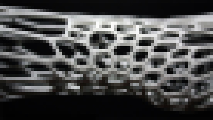 Photo 3D tlač v medicíne. Čo všetko sa dá dnes vytlačiť a aké prelomy nás čakajú?