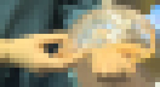 Photo Lekári vymenili lebku pacientky za náhradu zhotovenú 3D tlačou