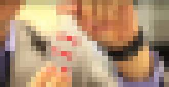 Photo Obväz budúcnosti s inteligentným vnútrom bude ranu nielen chrániť, ale aj liečiť