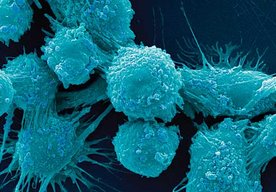 Photo Spiace imunitné bunky v nádoroch možno „prebudiť“ na boj s rakovinou