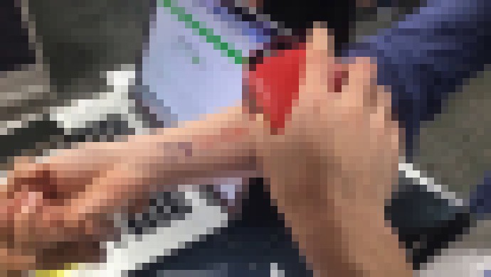 Photo Potetovať sa už môžete aj sami v pohodlí domova 