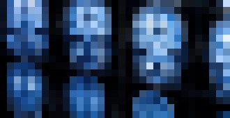 Photo Vedci z MIT vytvorili mozgový implantát, ktorý bude pumpovať liečivá priamo do lebky