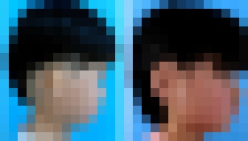 Photo Deti dostali nové uši. Vypestované boli z ich vlastných buniek 