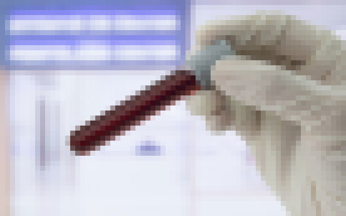 Photo Robot odoberie vzorky krvi pacientom zo žily a sám ich aj zanalyzuje