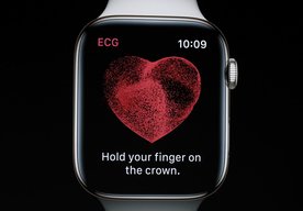 Photo Apple Watch 4 dostane aktualizáciu s funkciou EKG