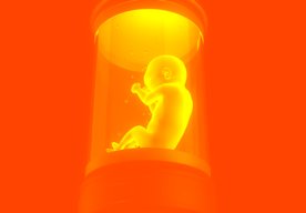 Photo Možno už o desať rokov sa budú ľudské embryá pestovať v umelých materniciach