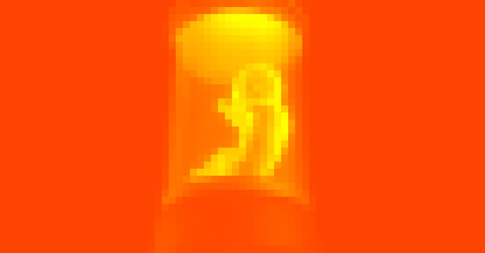 Photo Možno už o desať rokov sa budú ľudské embryá pestovať v umelých materniciach