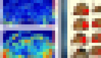 Photo 10x presnejší ultrazvuk umožní skoršie diagnostikovanie rakoviny