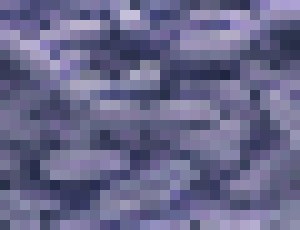 Photo Patogény odolávajúce antibiotikám môžu byť horšie ako COVID-19