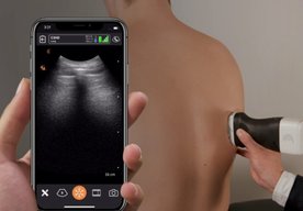 Photo Budúcnosť patrí vreckovým ultrazvukom
