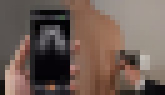 Photo Budúcnosť patrí vreckovým ultrazvukom