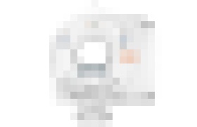 Photo Revolučné CT znižuje radiačnú záťaž