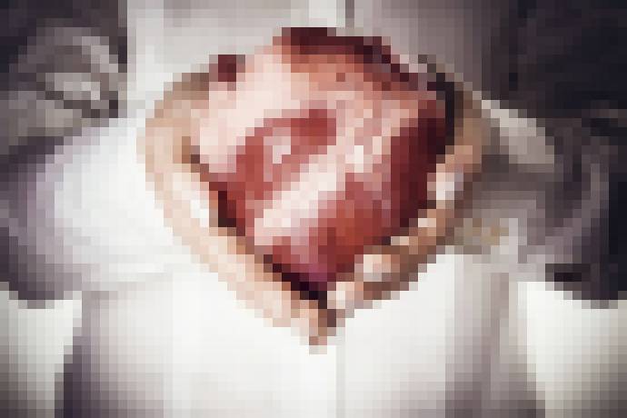 Photo Orgány vypestované v laboratóriu by mohli vyriešiť transplantačnú krízu