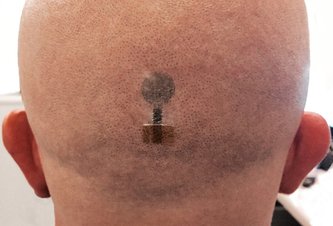 Photo Video: Grafénové tetovanie dokáže nepretržite monitorovať vaše mozgové vlny