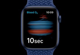 Photo Pre diabetikov: Smart hodinky od Apple aj Samsungu umožnia sledovať hladiny cukru v krvi