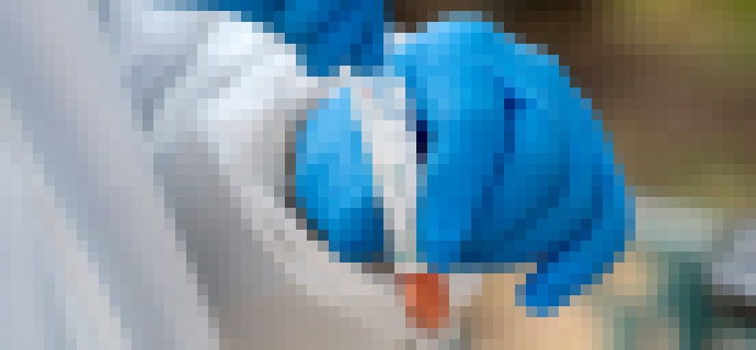 Photo Nástroj strojového učenia dokáže predpovedať vážny priebeh COVID-19