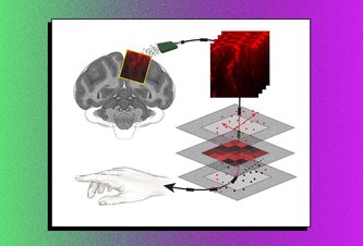 Photo Signály v ľudskom mozgu sa dajú bezbolestne a presnejšie prečítať pomocou ultrazvuku 