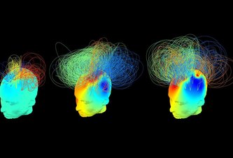 Photo EEG umožní lekárom povedať, či ste pri vedomí