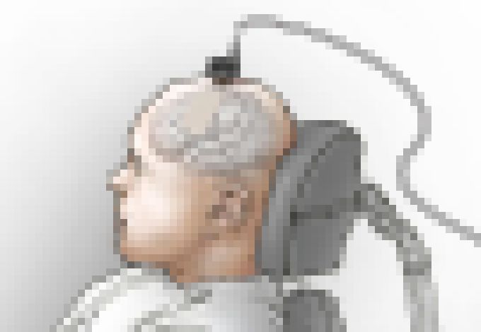 Photo Mozgový implantát mení myšlienky na slová, aby ochrnutý človek mohol zase „hovoriť“