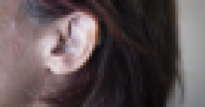 Photo Načúvacie prístroje budú lacnejšie a elegantnejšie