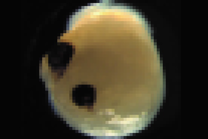 Photo Laboratórne vypestovaný minimozog si vytvoril oči, ktoré môžu „vidieť“