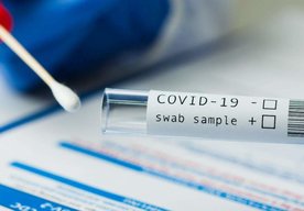 Photo FDA varuje, že niektoré testy na COVID-19 nemusia zachytiť omikron 