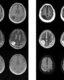 Photo Nové zariadenie MRI na snímkovanie mozgu je menšie, mobilné a podstatne lacnejšie