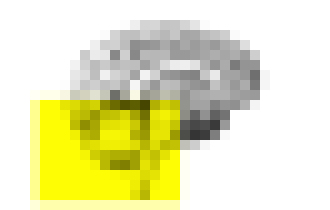 Photo Vedci našli mozgové centrum pre spiritualitu