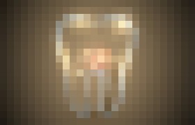 Photo Koniec zubným kefkám? Už čoskoro nám zuby budú čistiť nanoboty