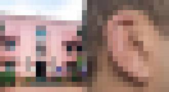 Photo Študent podvádzal na skúške pomocou bluetoothového zariadenia chirurgicky implantovaného v uchu