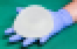 Photo Koniec silikónom? Na obzore je nová éra rekonštrukcie prsníka