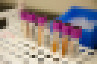 Photo Protilátky na COVID sa dajú zistiť aj z moču