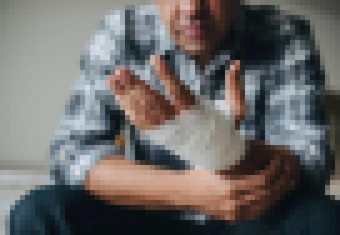 Photo Prelomové prírodné liečivo umožní kožným ranám hojiť sa dvakrát rýchlejšie