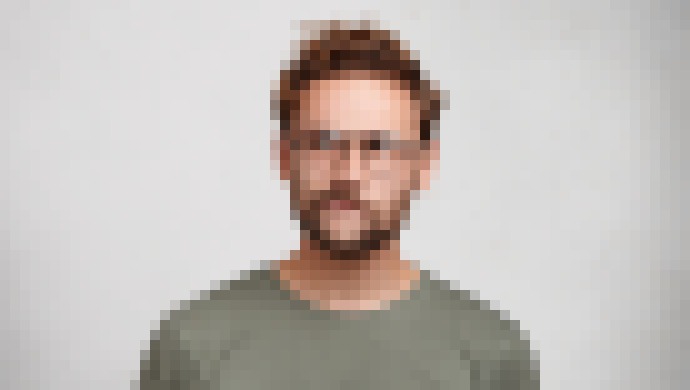 Photo Kedy je vhodný čas na laserovú operáciu očí?