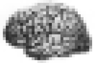 Photo Experimentálny liek môže opraviť poškodenie mozgu