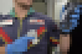 Photo Ručný ultrazvukový skener pomôže pri záchrane životov v teréne