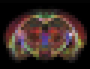 Photo Inovatívne zariadenie MR má 64 miliónov krát detailnejší obraz čo prináša úplne nové možnosti liečby