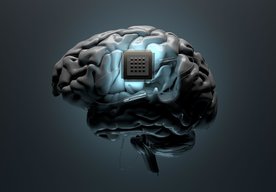 Photo Nový mozgový implantát umožní používať počítač iba myšlienkami