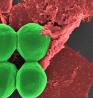 Photo Nanotechnológie likvidujú superbaktérie a urýchľujú hojenie rán