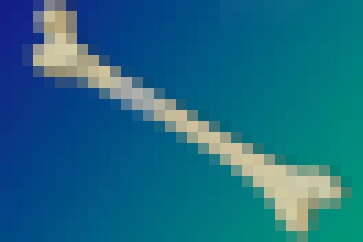 Photo Bioaktívny kompozit pomôže na výplň a hojenie zlomených kostí