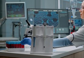 Photo Do nemocníc prichádzajú robotické zariadenia na odber krvi