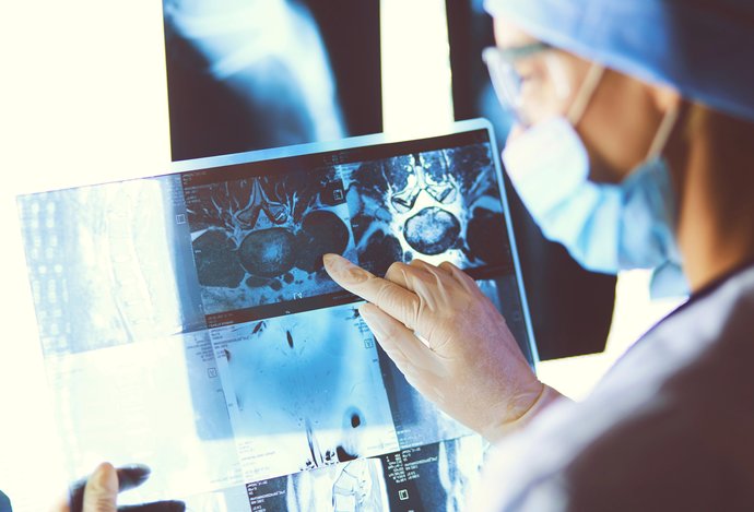 Photo Prielom v liečbe rakoviny: Mozgový nádor za päť dní takmer zmizol 