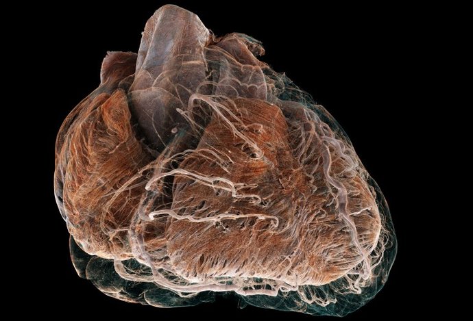 Photo Unikátna technológia umožňuje porovnať ako vyzerá zdravé a choré srdce 