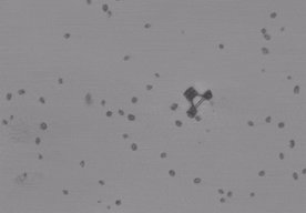 Photo Jedinečný spôsob ako poháňať mikroroboty plávajúce v ľudskej krvi  