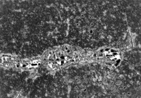 Photo Neuróny asi nevyzerajú tak, ako sme si mysleli