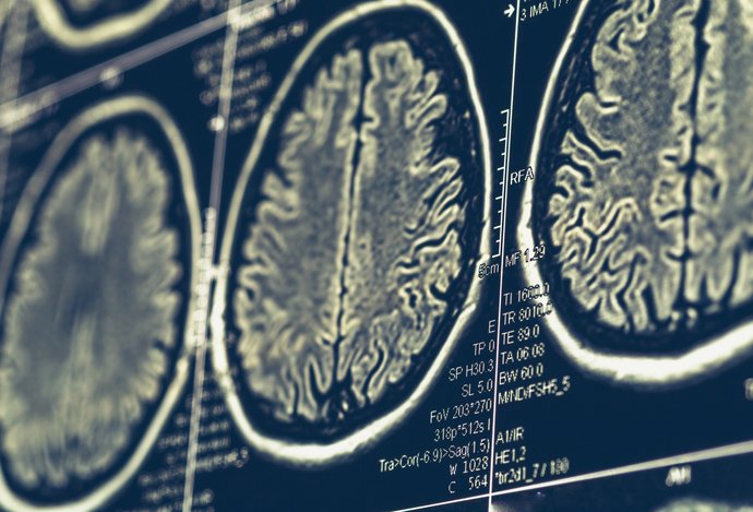 Photo Prelomové zariadenie by mohlo obnoviť poškodené funkcie mozgu