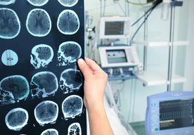 Photo Inovatívny spôsob operácie mozgu bez otvorenia lebky