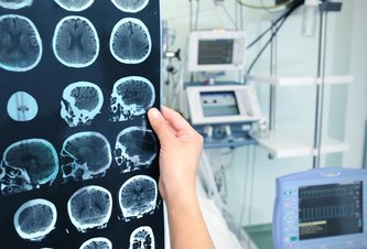 Photo Inovatívny spôsob operácie mozgu bez otvorenia lebky